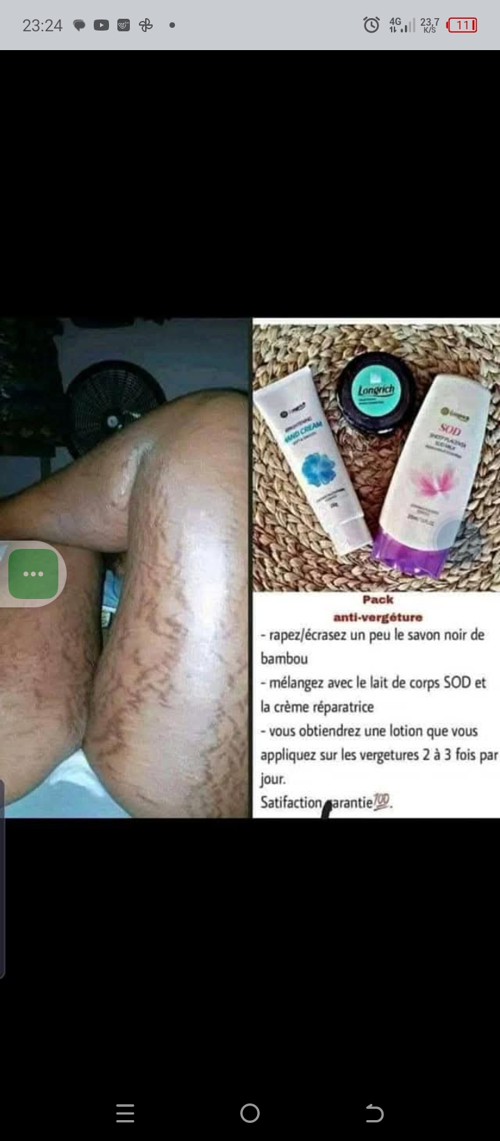 Kit vergetures LONGRICH 